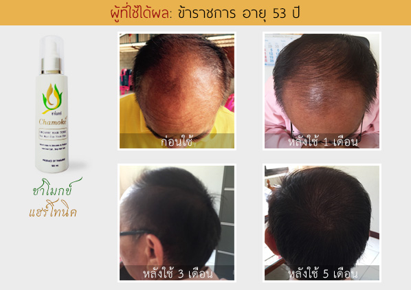 ตัวอย่างผู้ใช้